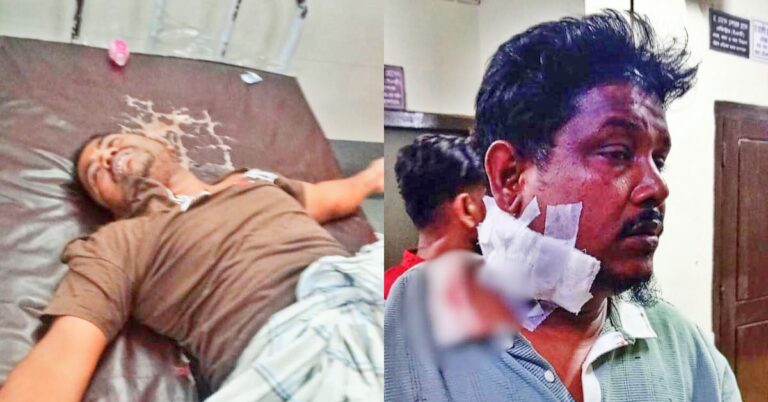 জিইসি মোড়ে ঈদের ব্যানার টাঙানো নিয়ে বিএনপির দুপক্ষে গোলাগুলিতে আহত ৪, কপাল পুরল খুলশী থানার ওসি মুজিবুরের